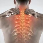 How an Upper Back Herniated Disc Can Lead to Pain, Numbness, and Weakness