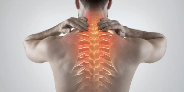 How an Upper Back Herniated Disc Can Lead to Pain, Numbness, and Weakness