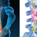 Early Signs of Cervical & Lumbar Spondylosis You Shouldn’t Ignore