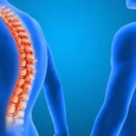Slipped Disc: Causes, Symptoms, and Modern Treatment Options