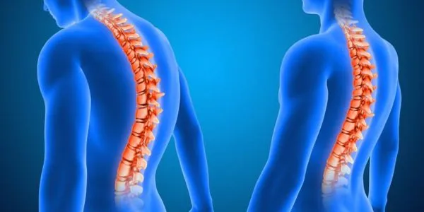 Slipped Disc: Causes, Symptoms, and Modern Treatment Options