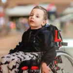 Spinal Muscular Atrophy: Diagnosis and Care Options