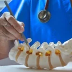 What is Microdiscectomy? A Complete Guide to Herniated Disc Treatment