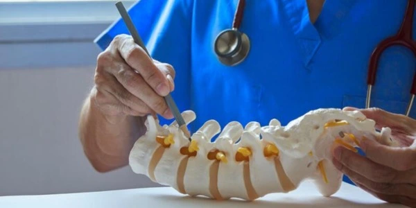 What is Microdiscectomy? A Complete Guide to Herniated Disc Treatment