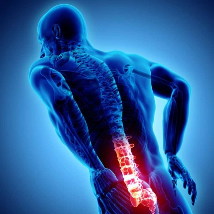 back-pain