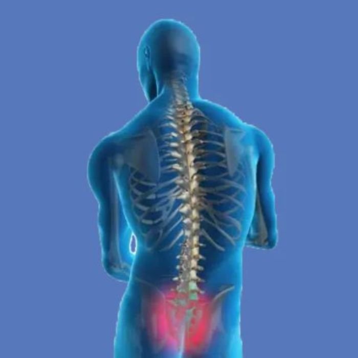 Sacroiliac-Joint-Pain